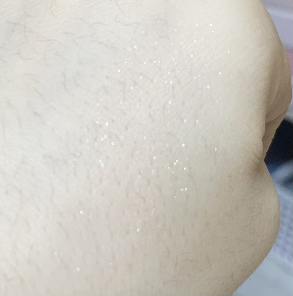 펄감
