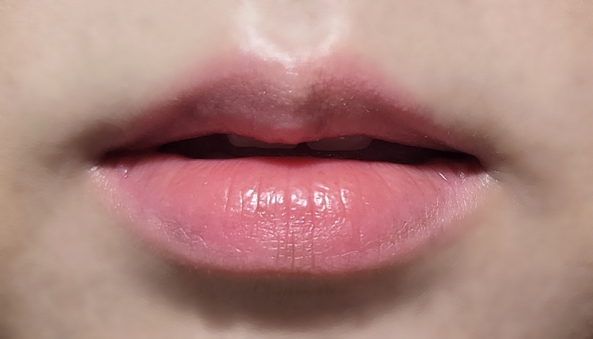 착색