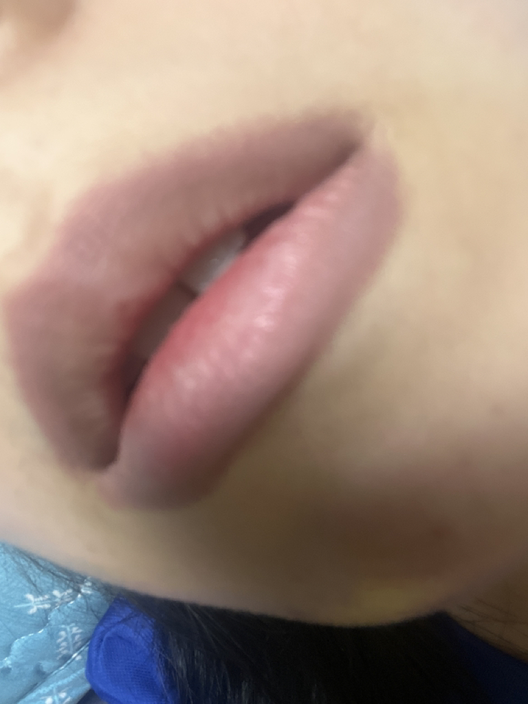 입술 발색