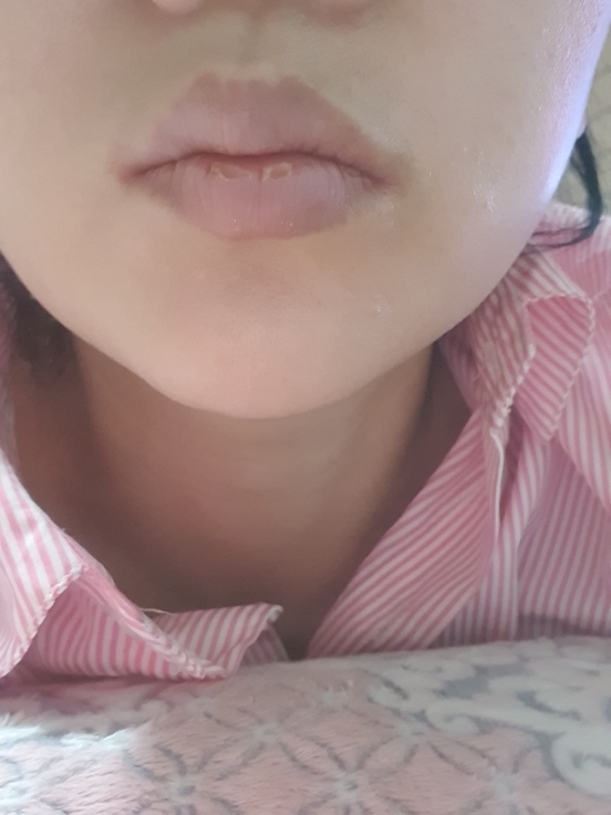입술 발색