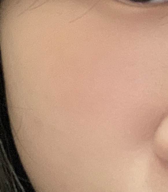 볼 발색