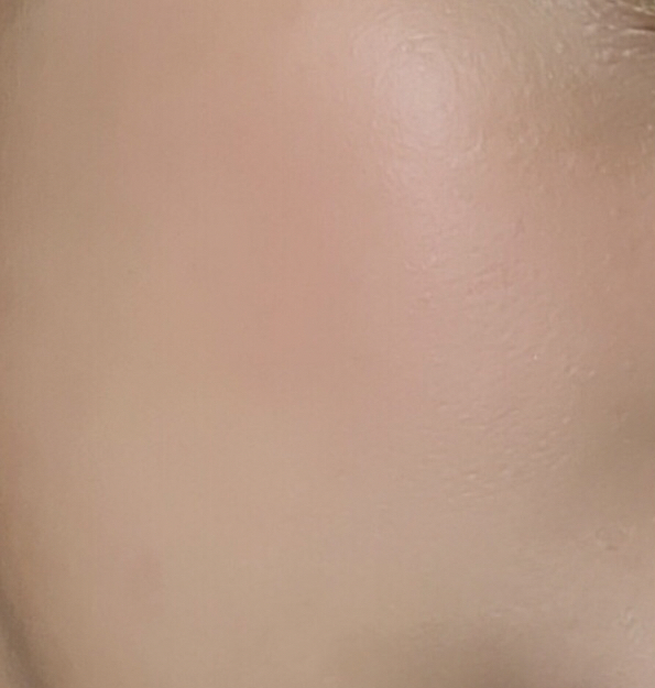 볼 발색