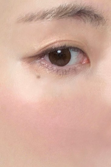 볼 발색