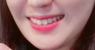입술 발색
