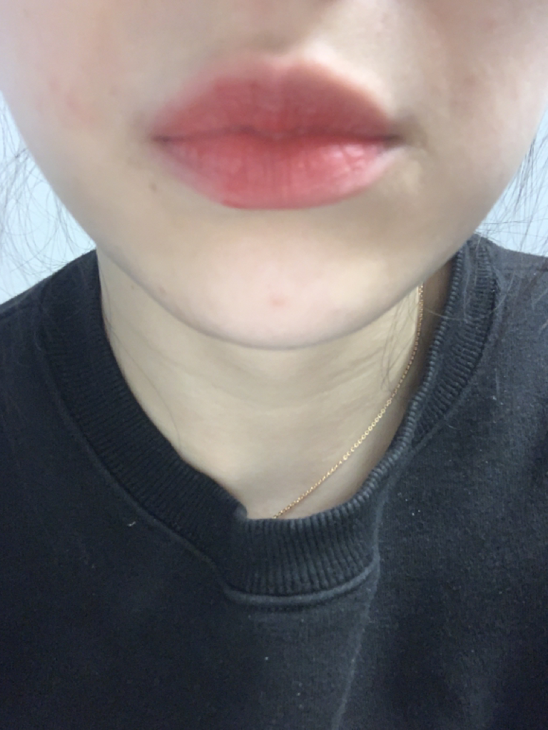 입술 발색