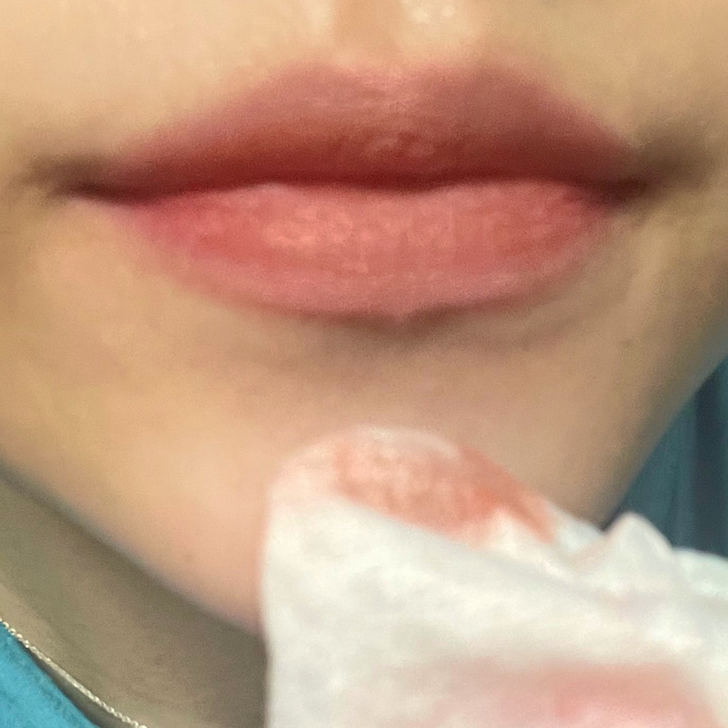 착색