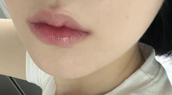 입술 발색