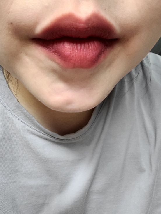 입술 발색