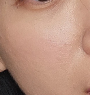 볼 발색