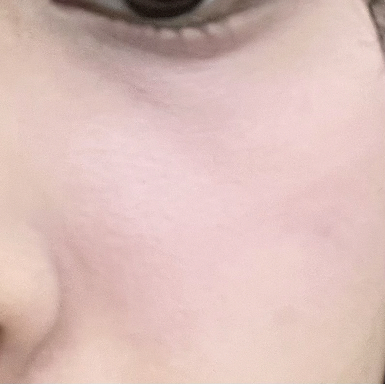 볼 발색