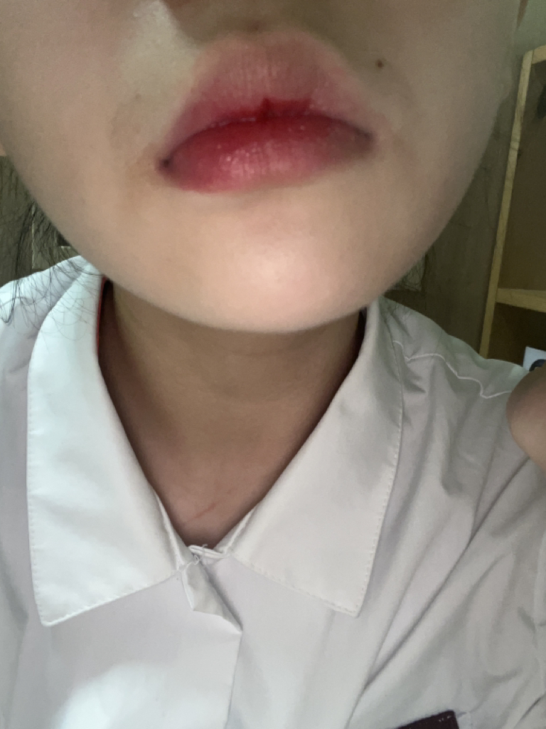입술 발색