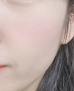 볼 발색
