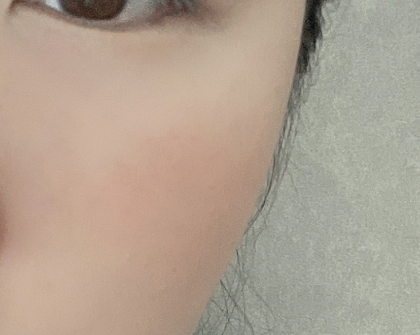 볼 발색