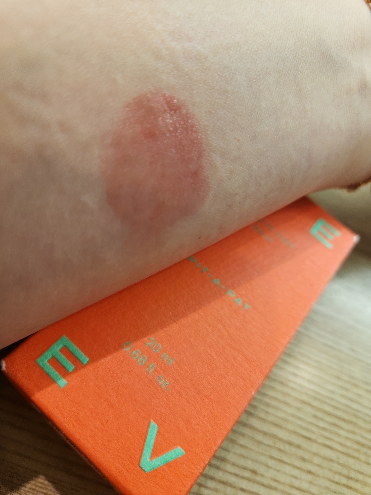 팔목 발색