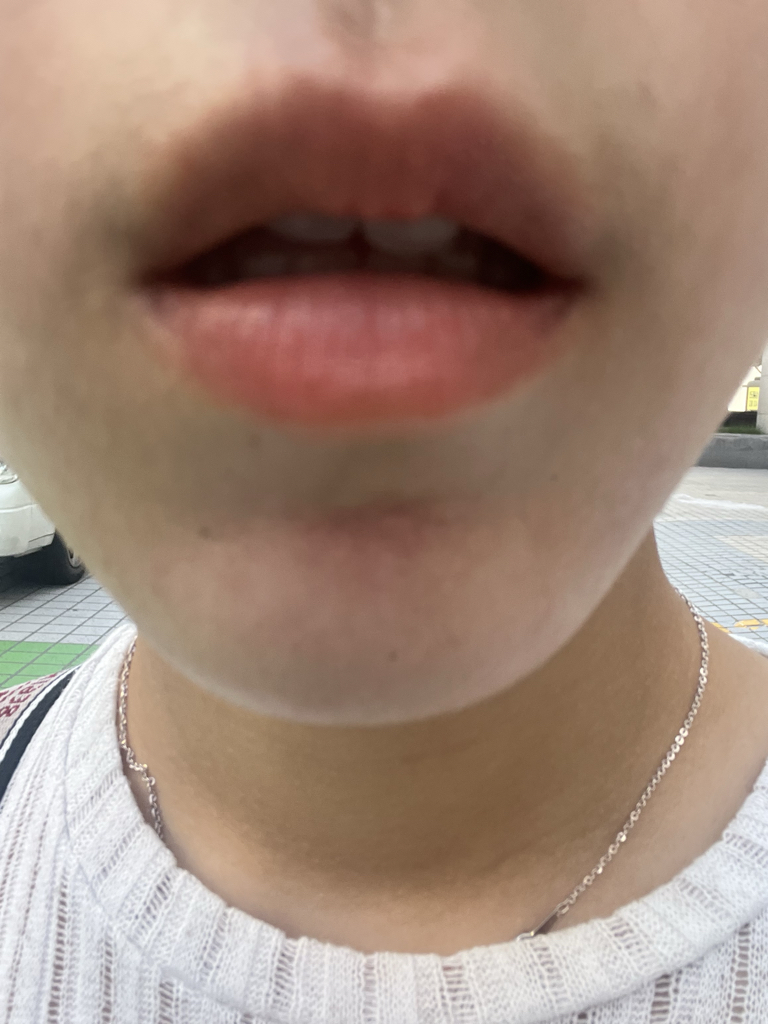 입술 발색