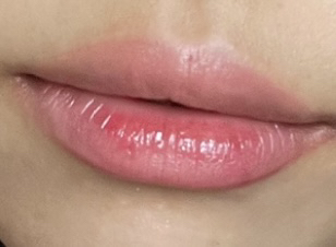 착색
