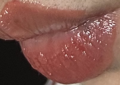 입술 발색