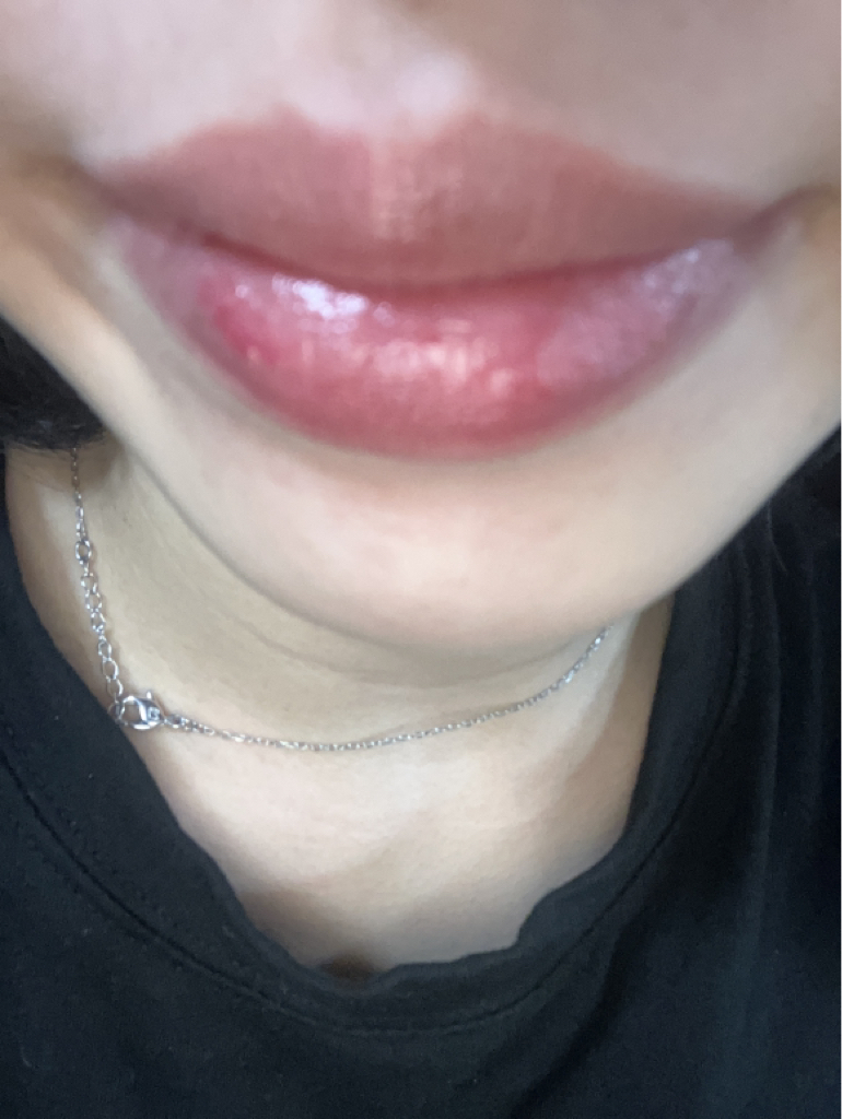 착색