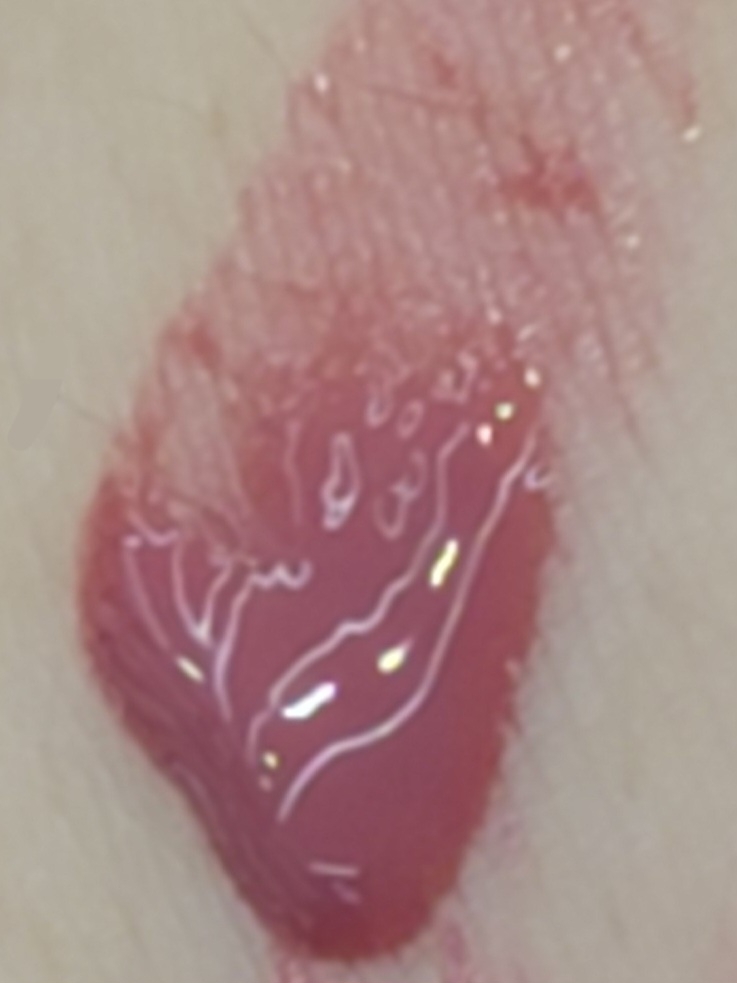 팔목 발색