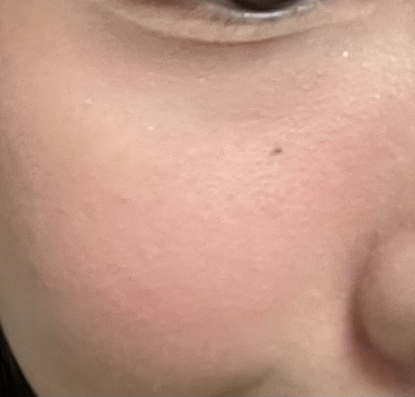 볼 발색