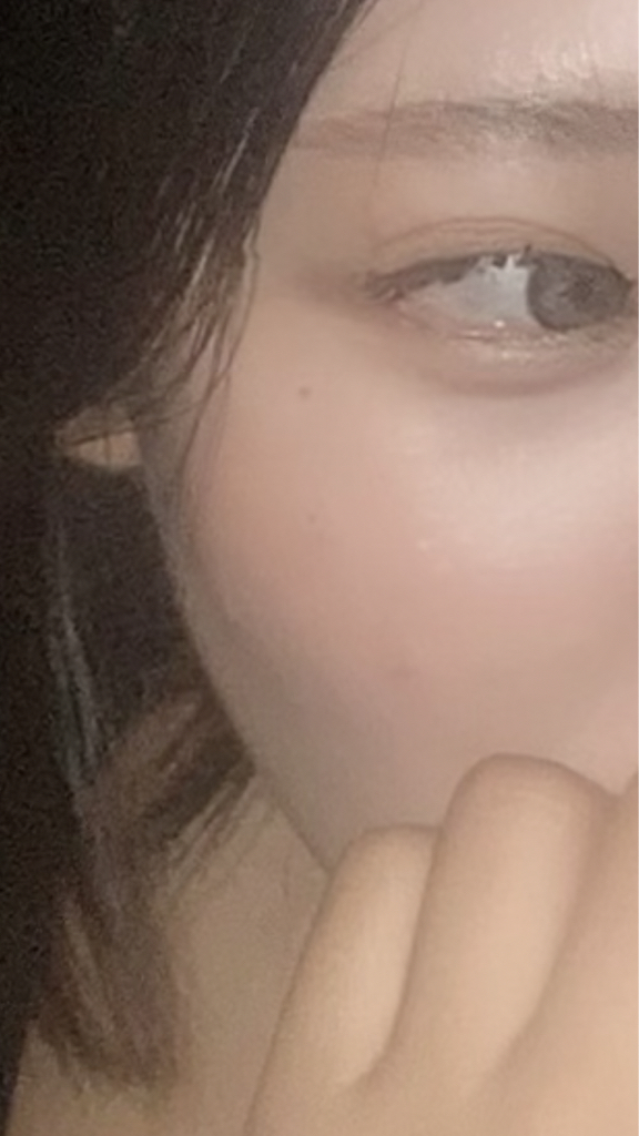 볼 발색