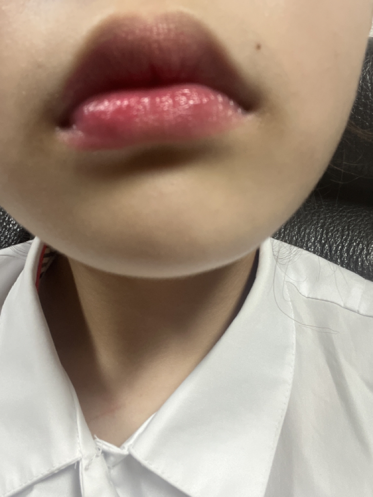 입술 발색