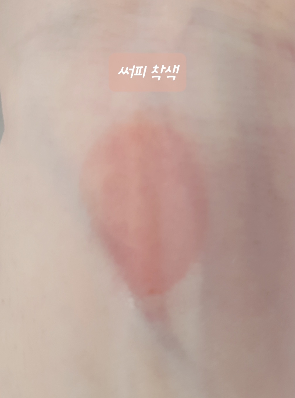 착색