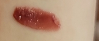 팔목 발색