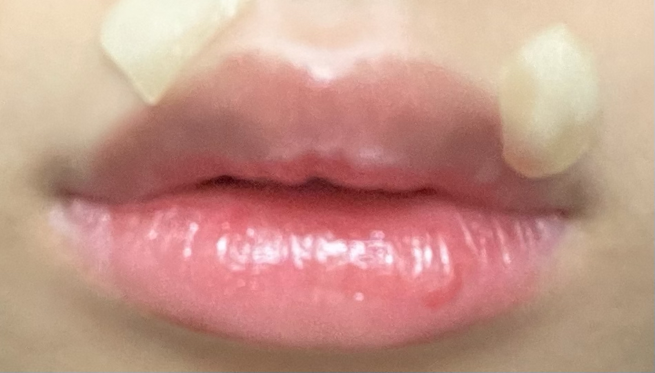 입술 발색