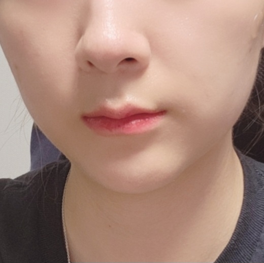 입술 발색