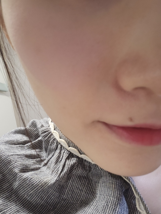 볼 발색