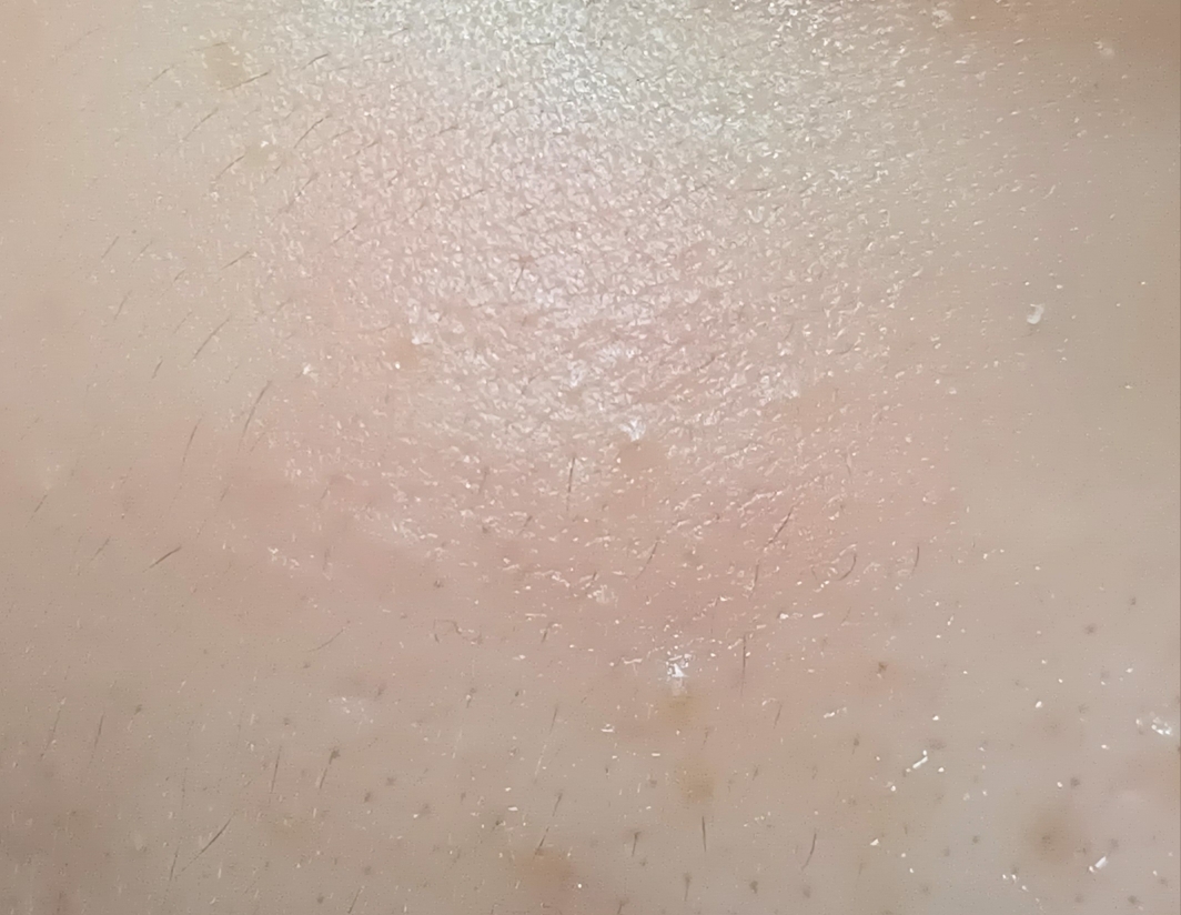 볼 발색