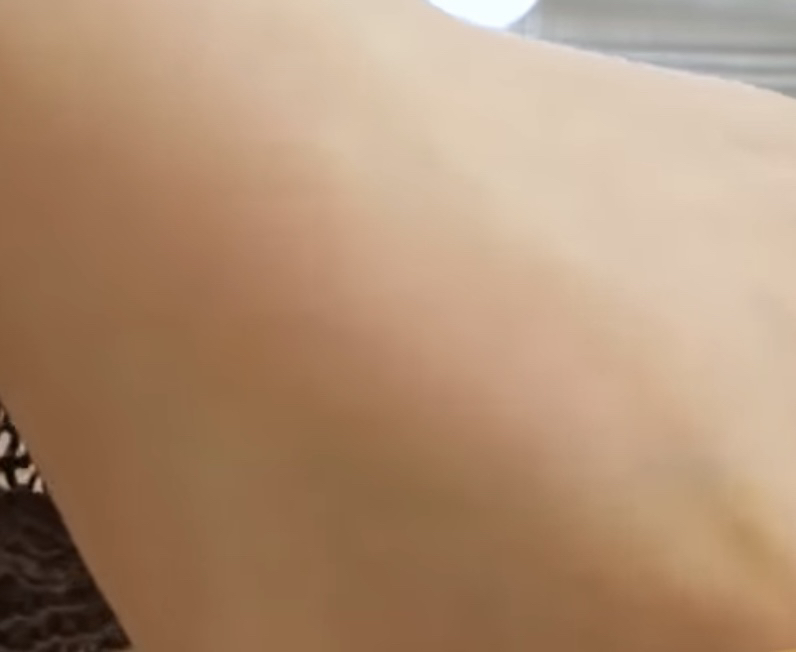 팔목 발색