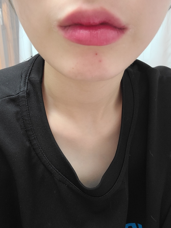 입술 발색