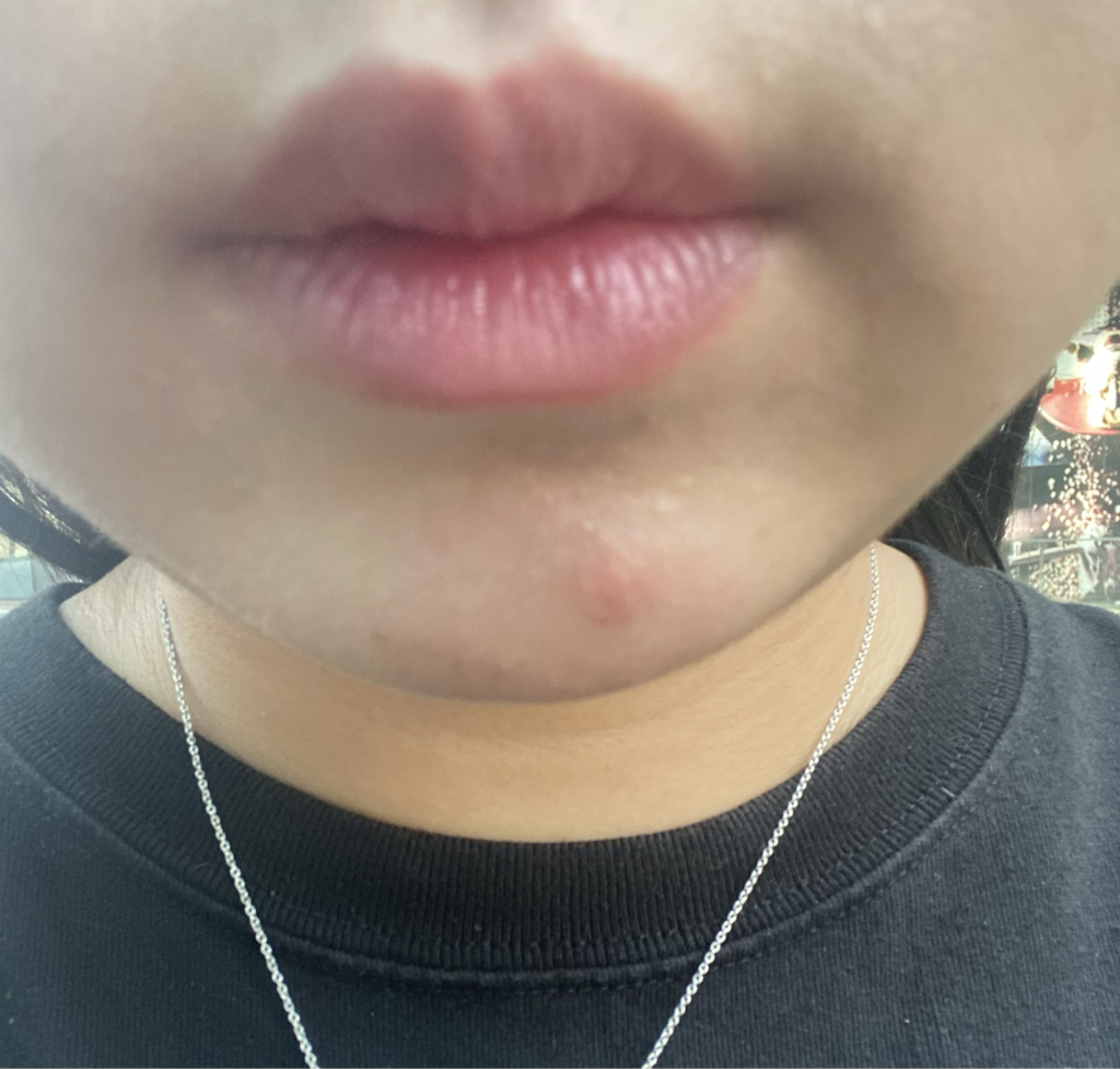 입술 발색