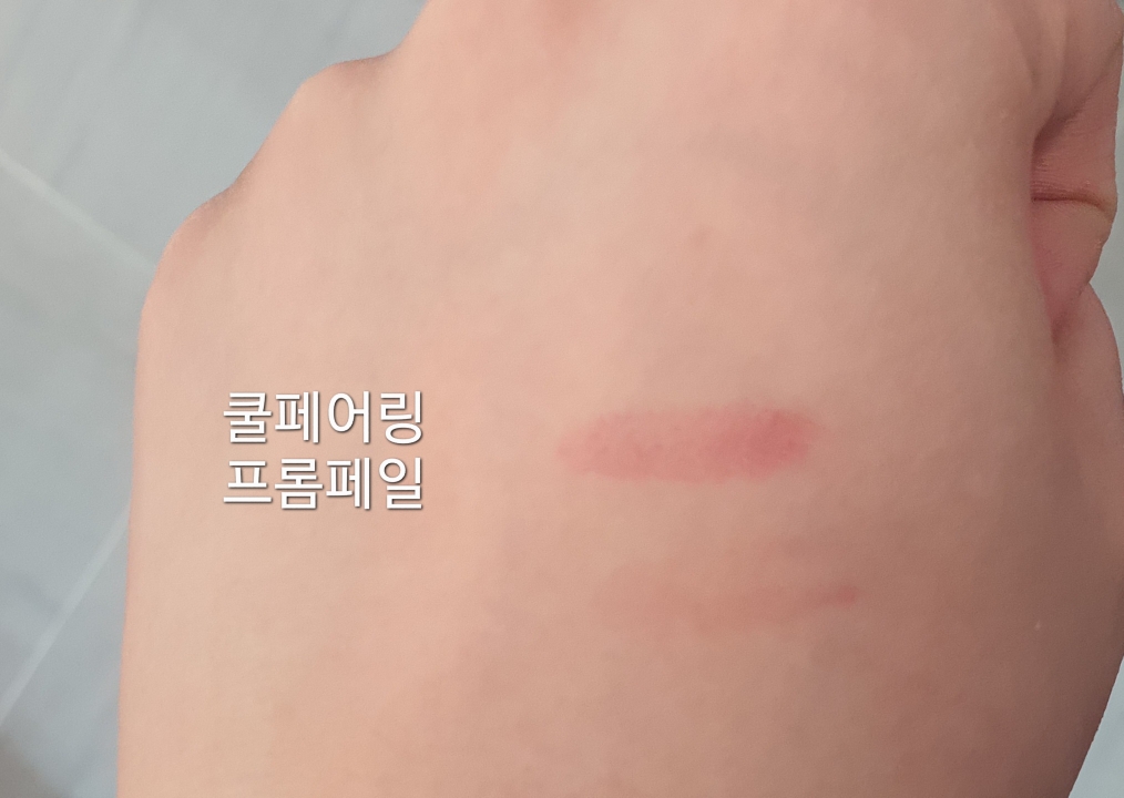 착색