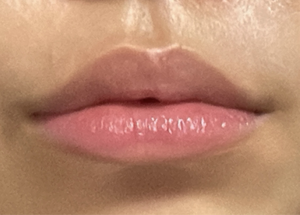 착색