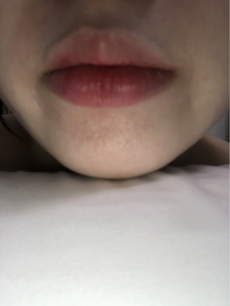 입술 발색