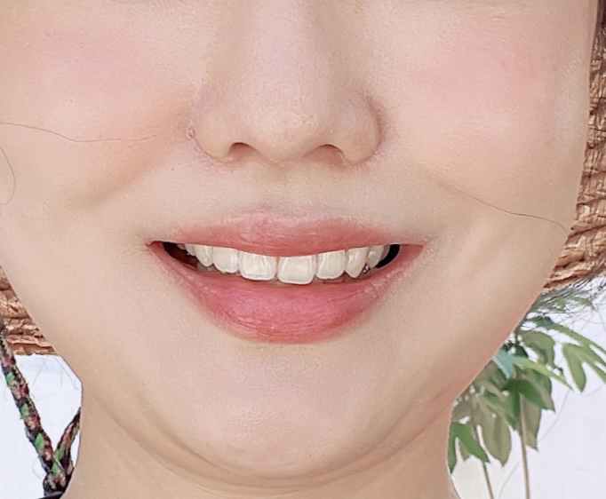 입술 발색
