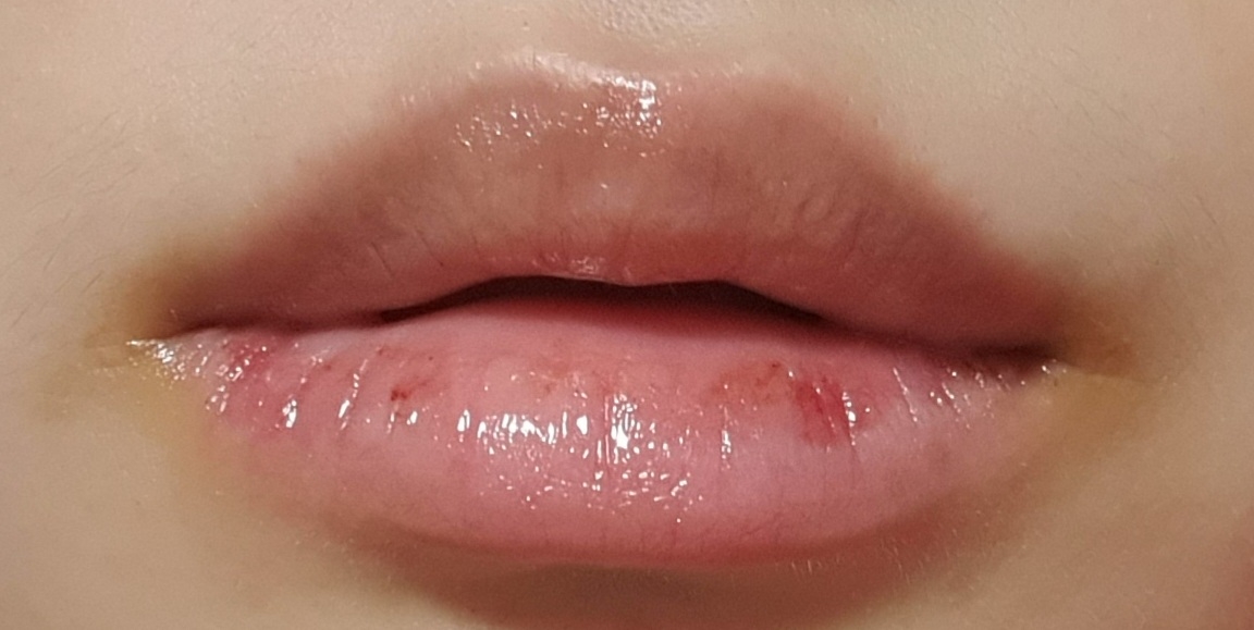입술 발색