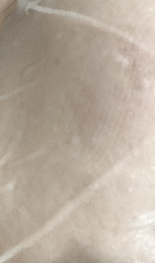 ROVECTIN 医生面罩 common.review image