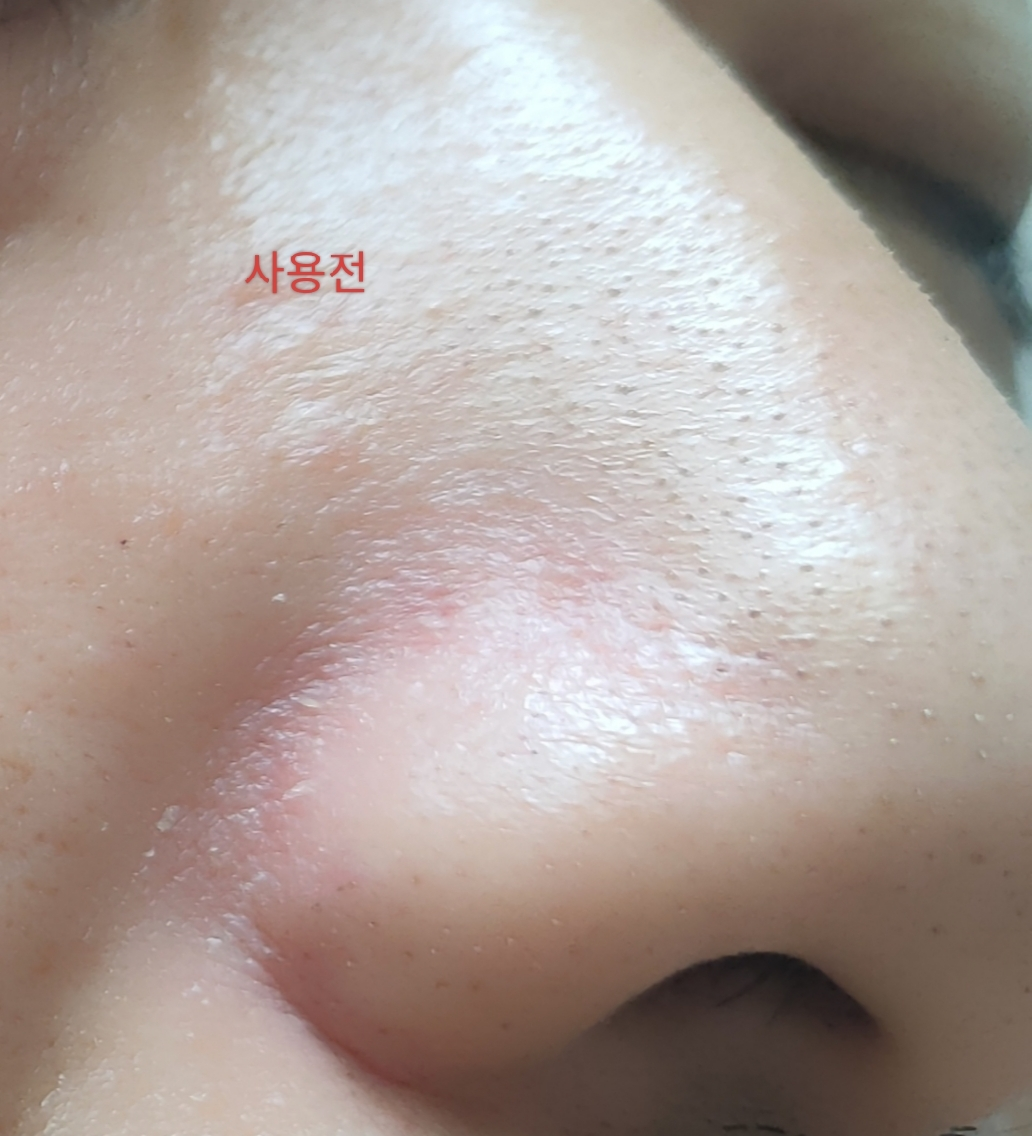 원데이즈유 (One-day'syou) 피지쓱싹 딥 클렌징 폼 review image