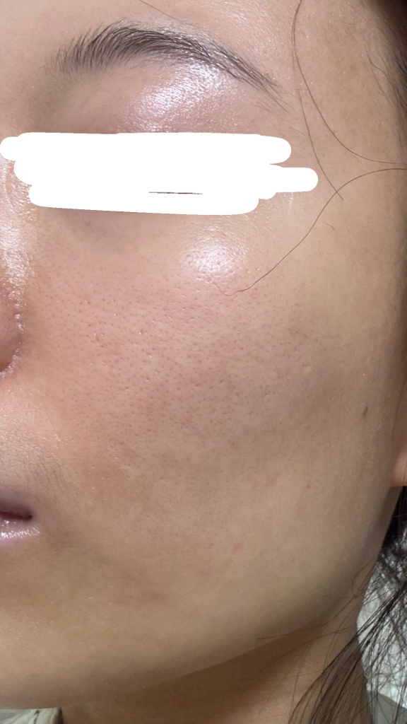 超级胶原蛋白面膜的真实用户使用照片