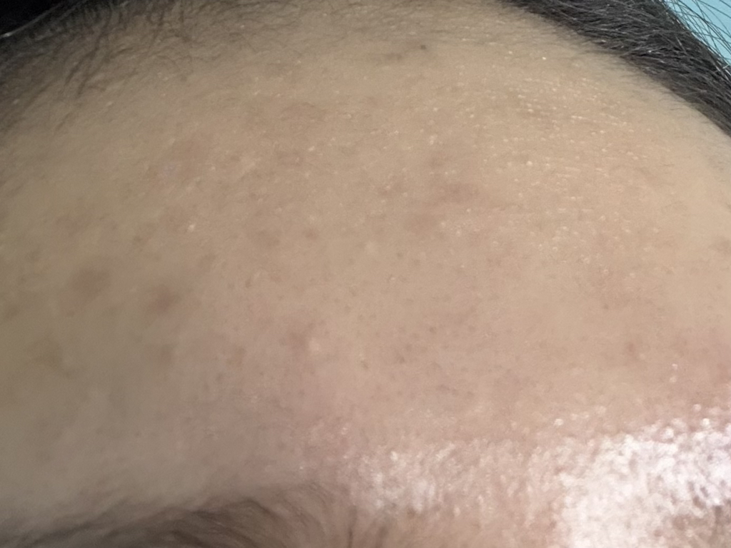 뤼산드 (LUCINDE) PDRN 연어 DNA 앰플 review image