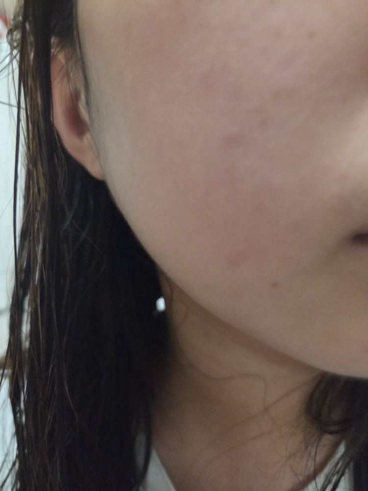 asolution 马蹄莲清洁爽肤水垫 common.review image