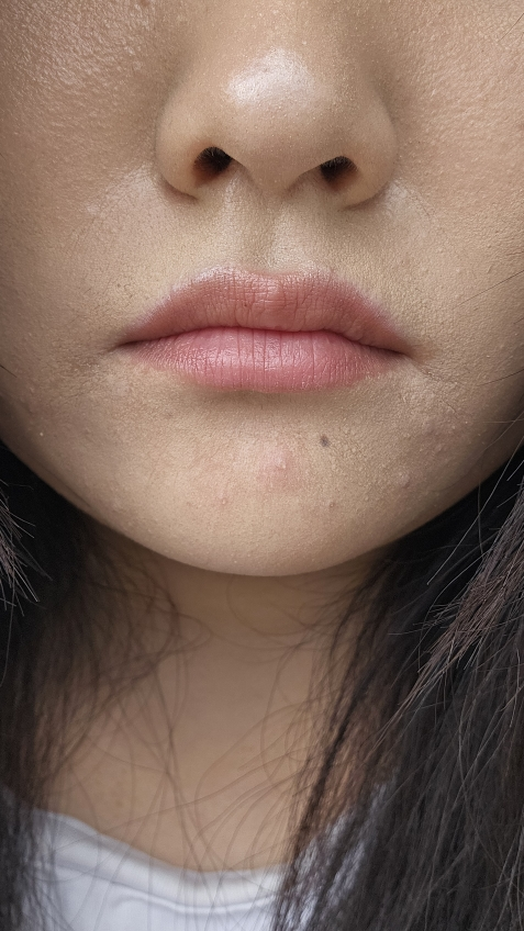 清爽舒缓保湿啫喱霜的真实用户使用照片