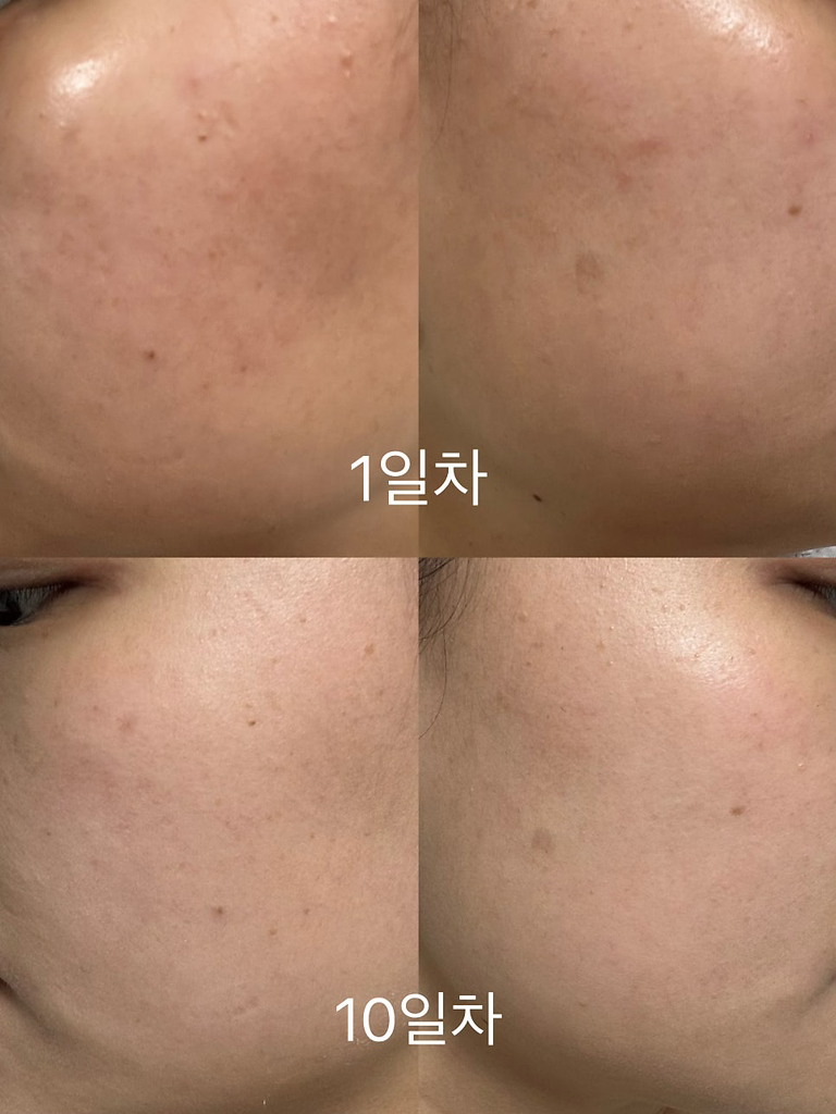 로벡틴 (ROVECTIN) 비타 다크 스팟 세럼 review image