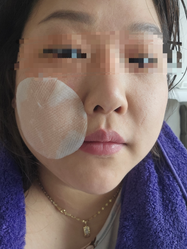 녹두 모공 클리어링 필터 패드 review image