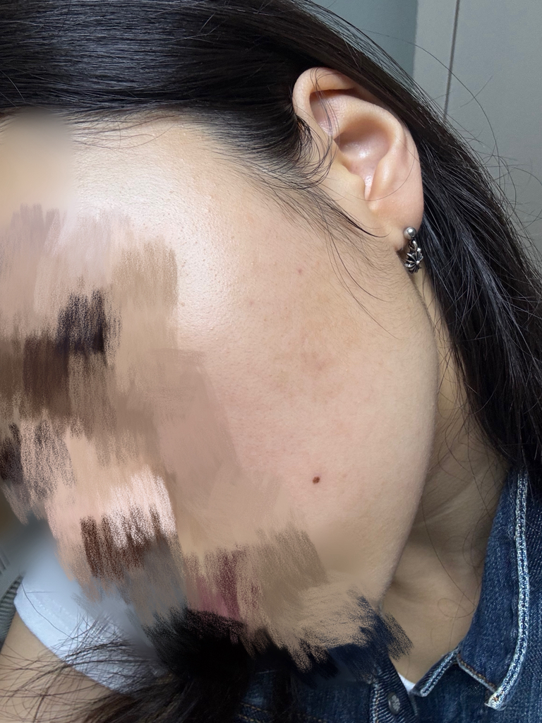特拉克尼365活性精华液的真实用户使用照片