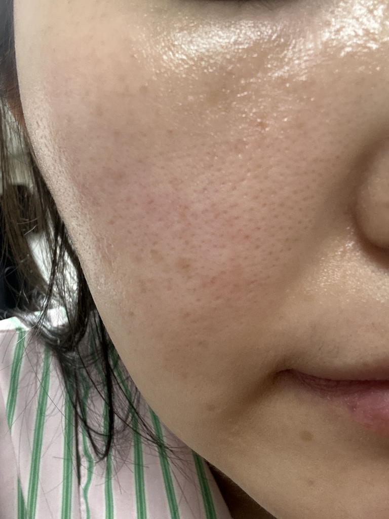 하이클 (HYCL) 라하 톤앤글로우 소프트닝 세럼 review image